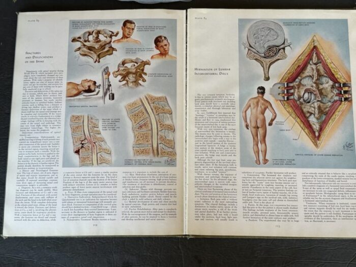 vintage medical illustrations book 9635